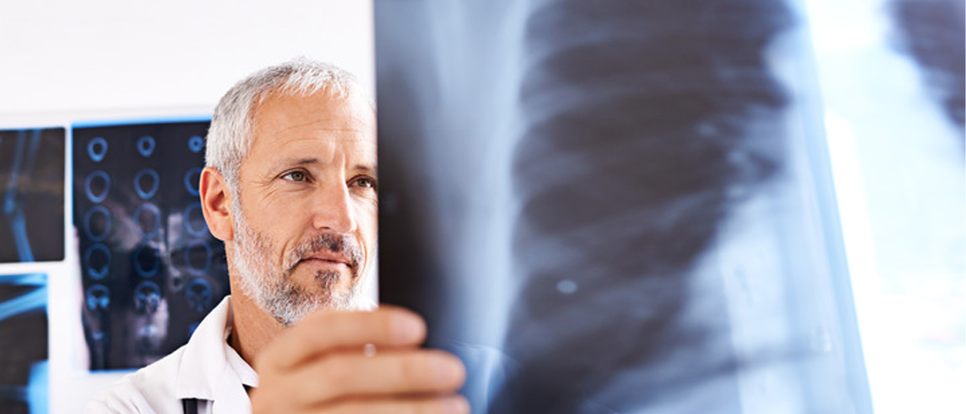 Lung Cancer: Understanding the Disease and Your Rights